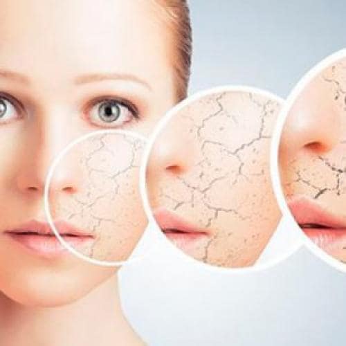 مراقبت از پوست خشک و حساس مراقبت از پوست خشک و حساس